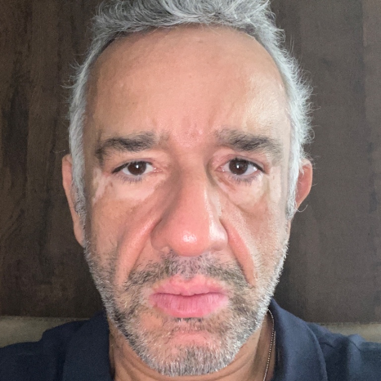 Bruno Antonio De Oliveira