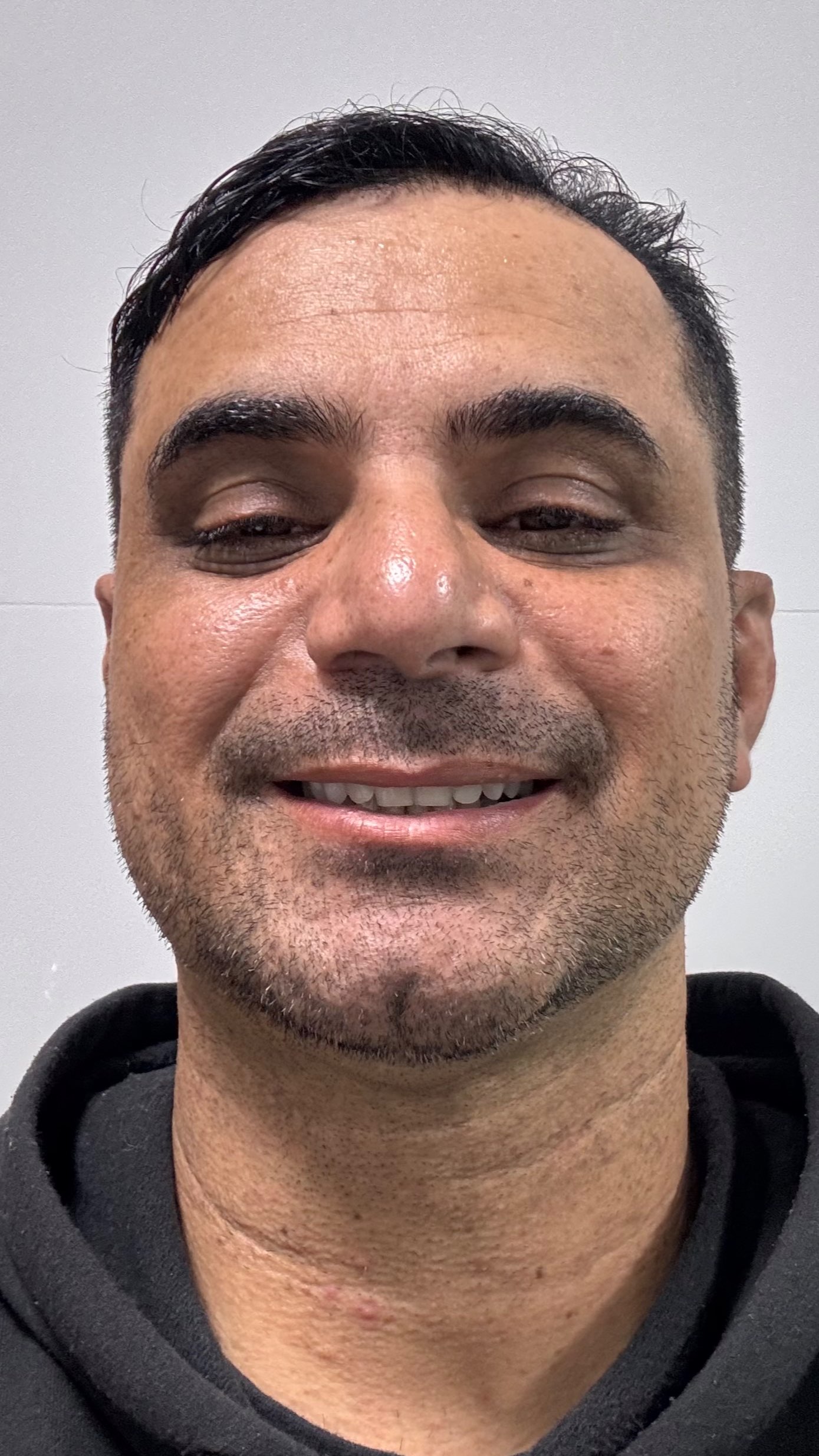 Ariosmar José De Lima